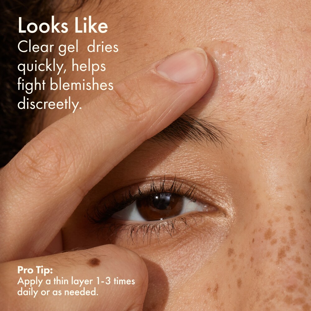 Super Spot Remover™ BLEMISH TREATMENT GEL, 10 ml
