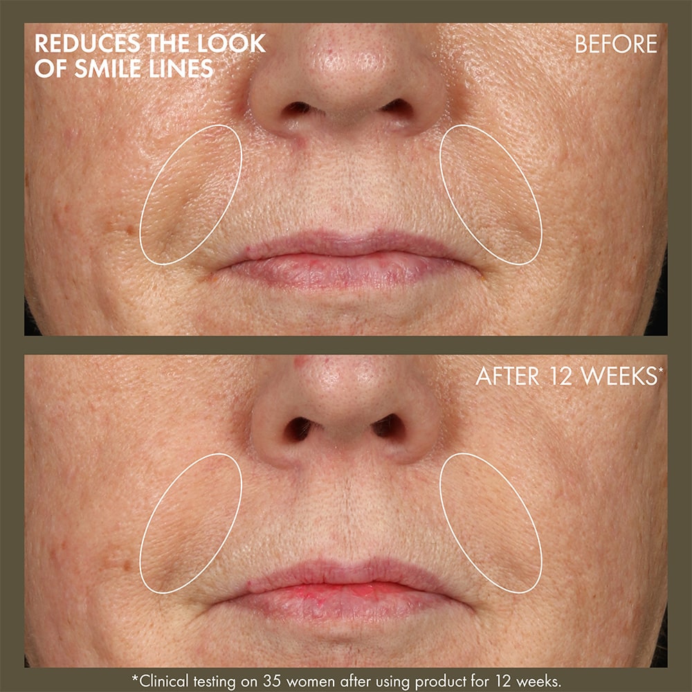 Plantscription™ Active Wrinkle Correction Serum, 48ml