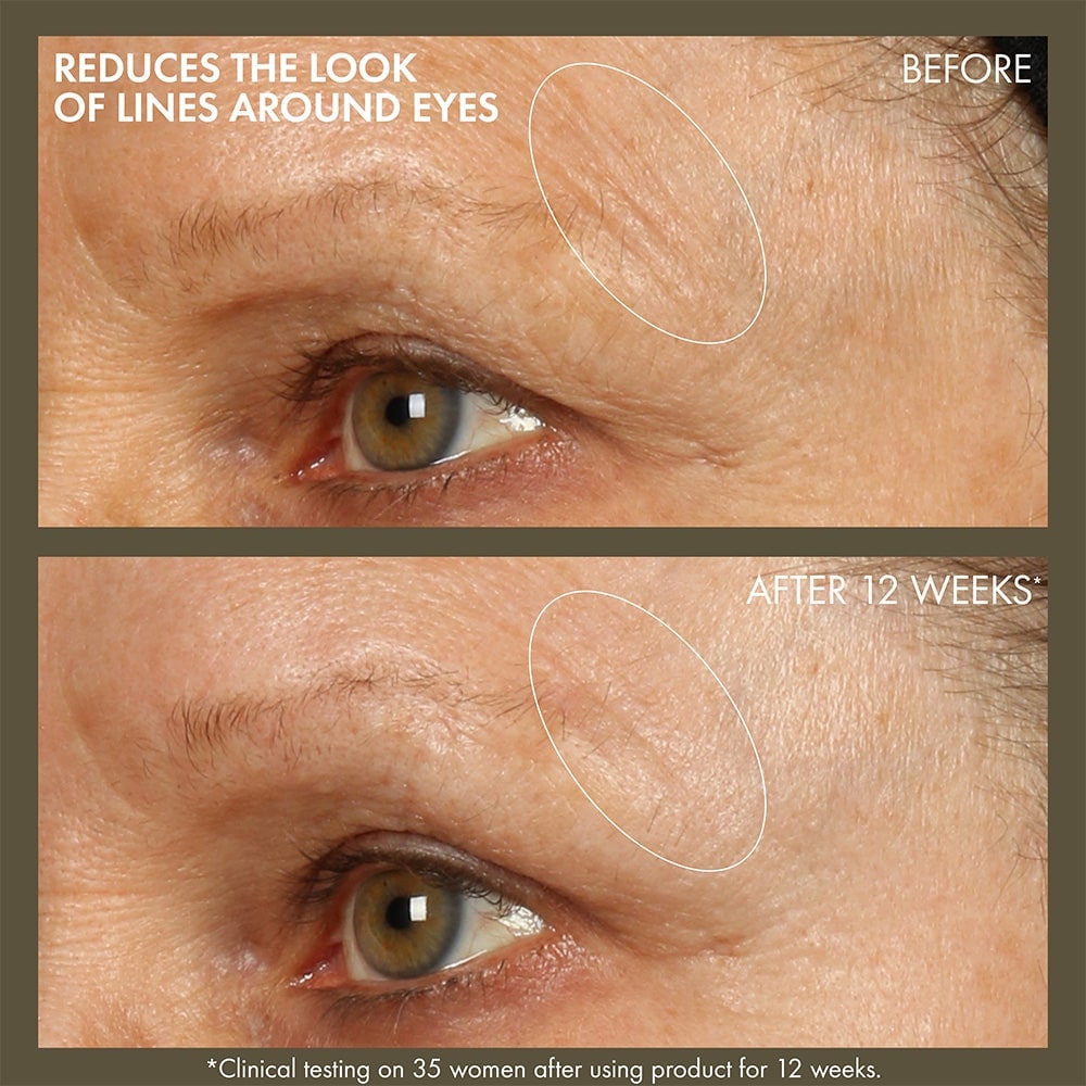 Plantscription™ Active Wrinkle Correction Serum, 48ml