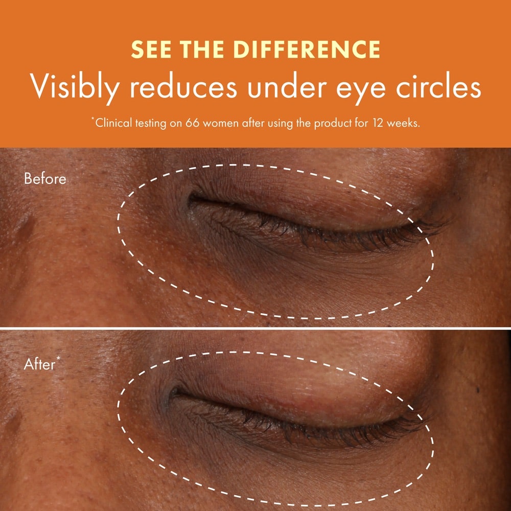 Ginzing™ Brightening Eye Cream - Cool, Full Size + Deluxe Sample